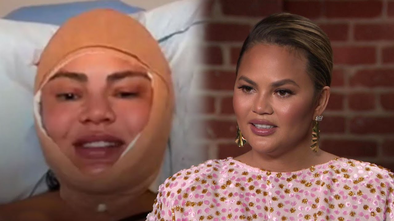 Chrissy Teigen Makes SURPRISING Plastic Surgery Reveal
