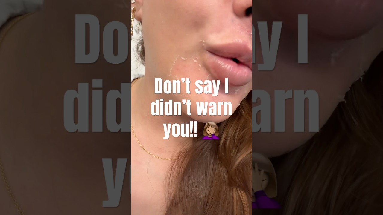 Don't Say I Didn't Warn You: ZO Skin Health Radical Night Repair Results! 😱✨